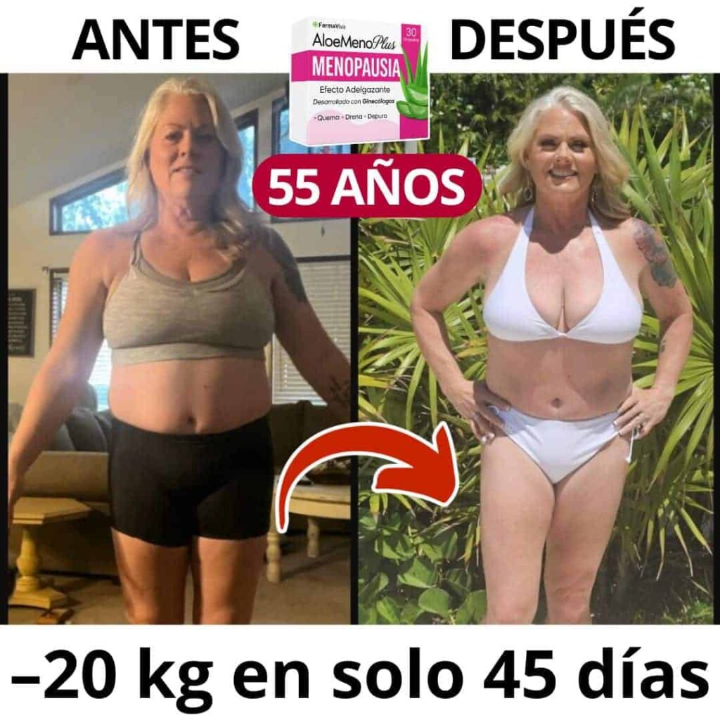 Donna di 55 anni prima e dopo perdita di peso con AloeMeno Plus.