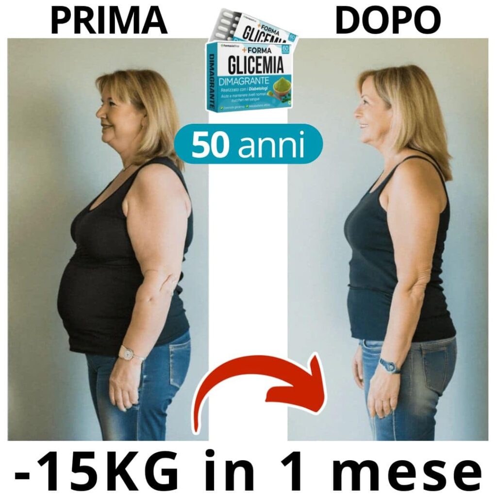 Donna di 50 anni prima e dopo perdita di peso di 15kg.